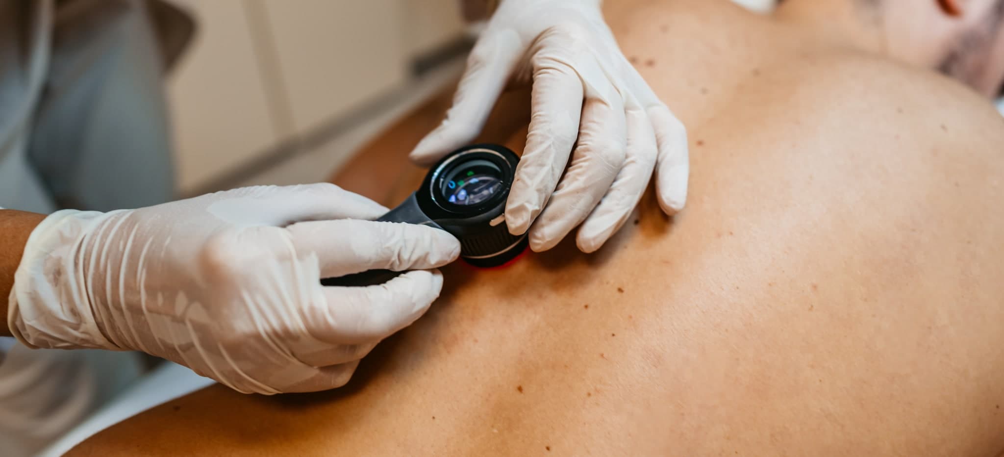 S1-Leitlinie Bildgebende Diagnostik von Hauterkrankungen