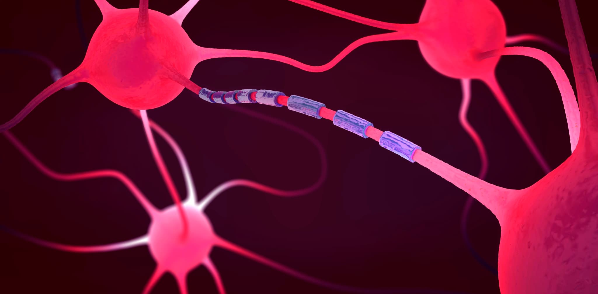Neurone pink