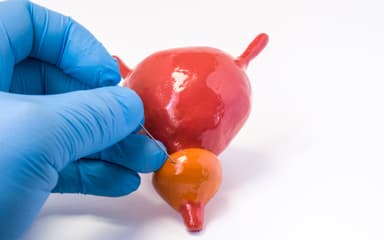 Titelbild von Fördern Prostatabiopsien die Verbreitung von Krebszellen?