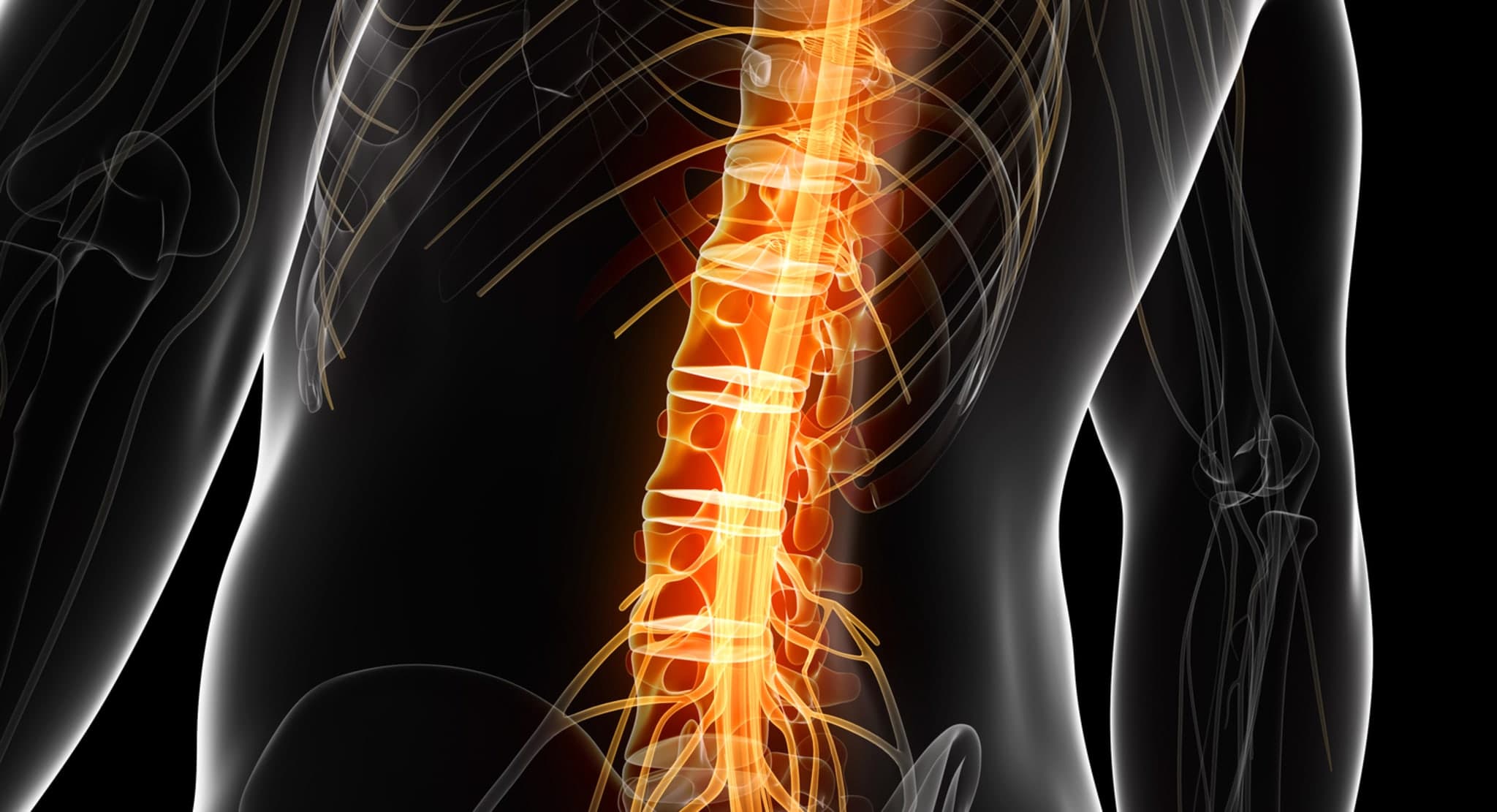 S3-Leitlinie Epidurale Rückenmarkstimulation zur Therapie chronischer Schmerzen