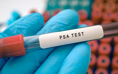 Titelbild von Prostatakrebs-Früherkennung: Längere Screening-Intervalle bei niedrigem Basis-PSA angezeigt