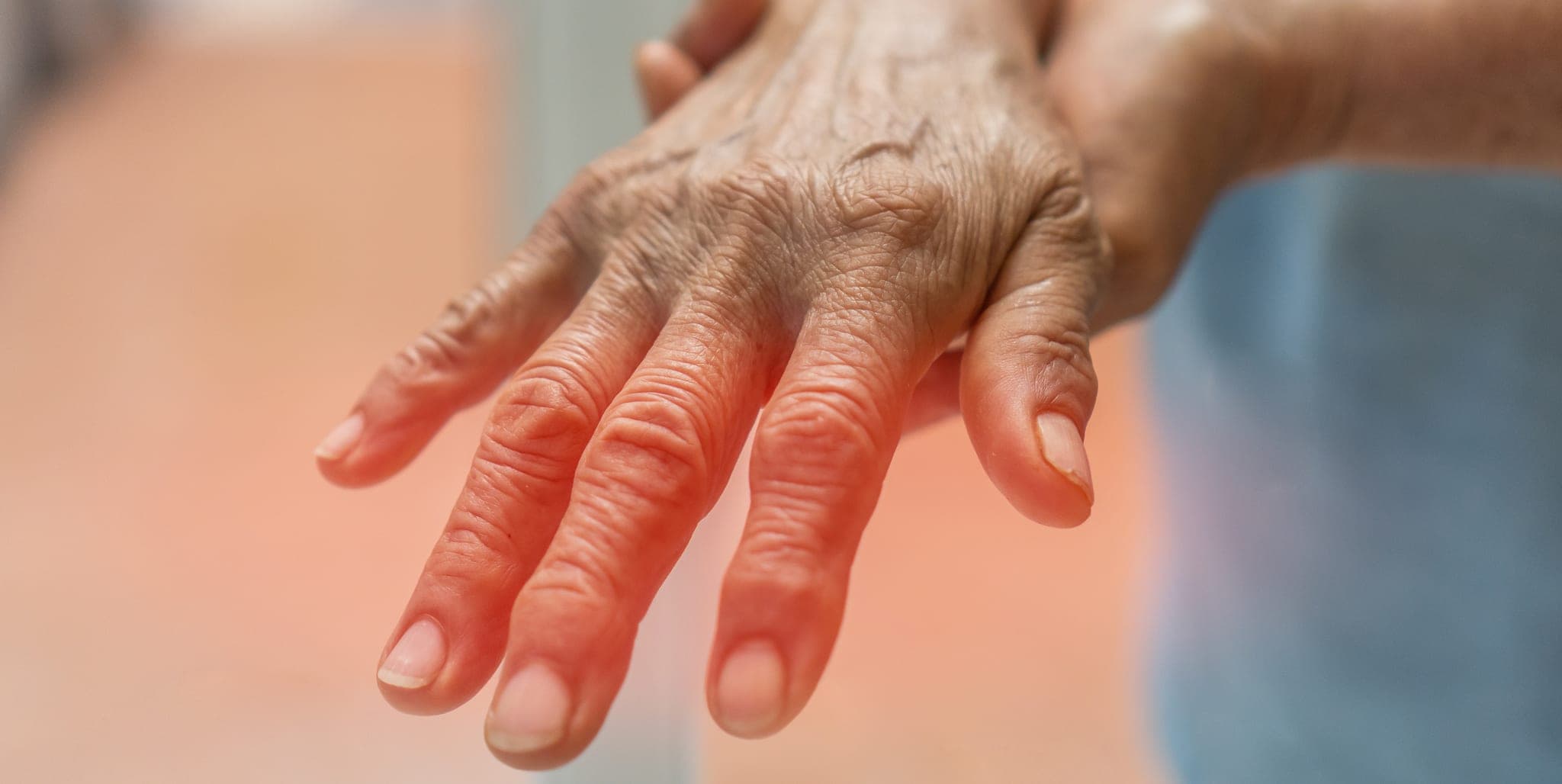 S1-Leitlinie Diagnostik bei Polyneuropathien