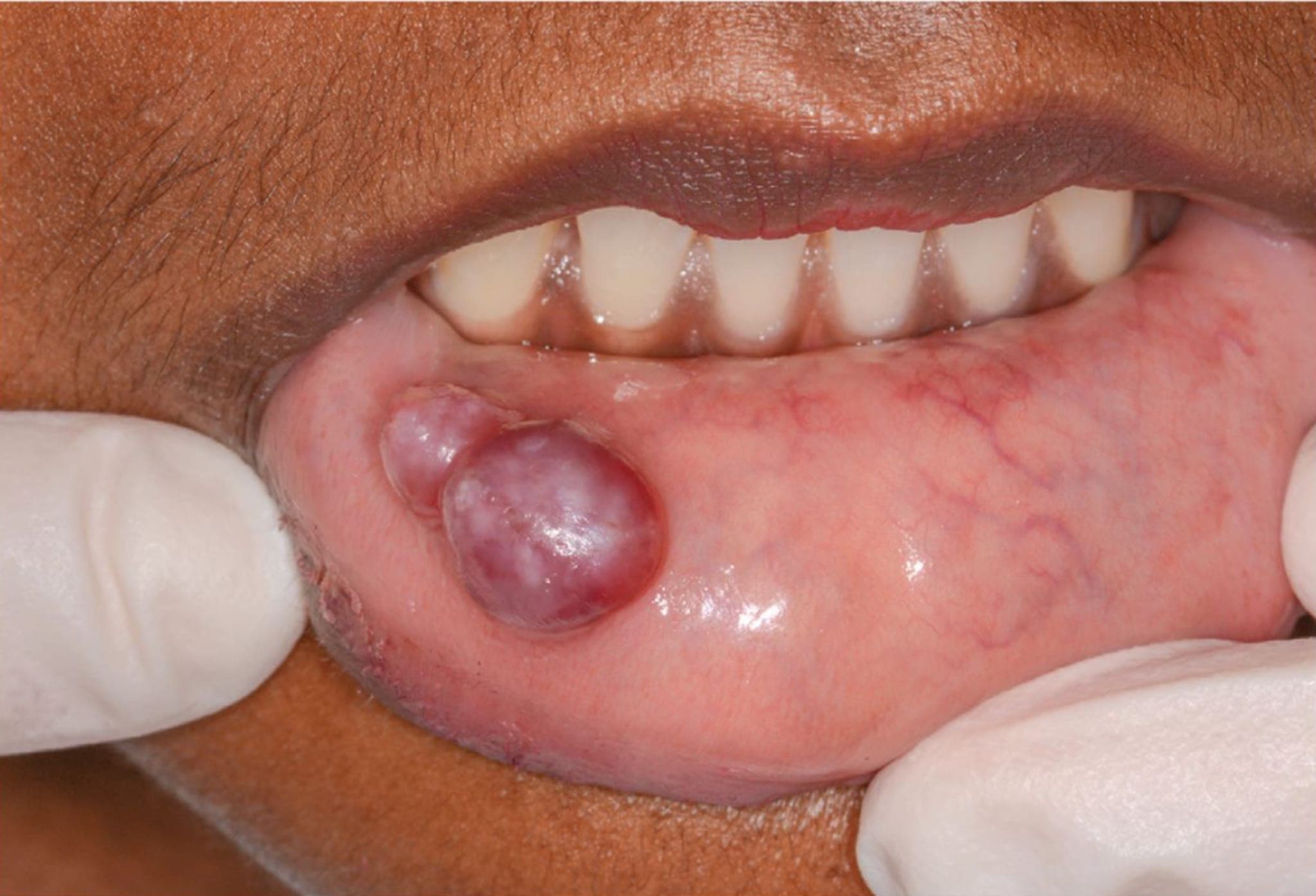 Bild der Woche: Dicke Lippe