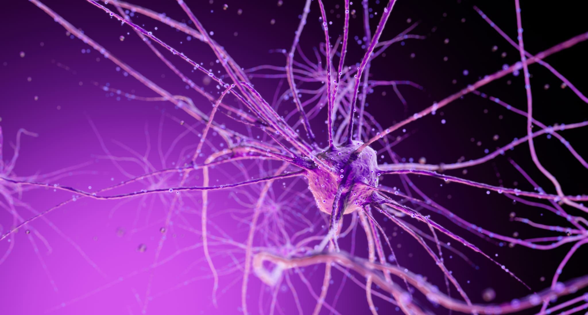 Neurone pink/schwarz