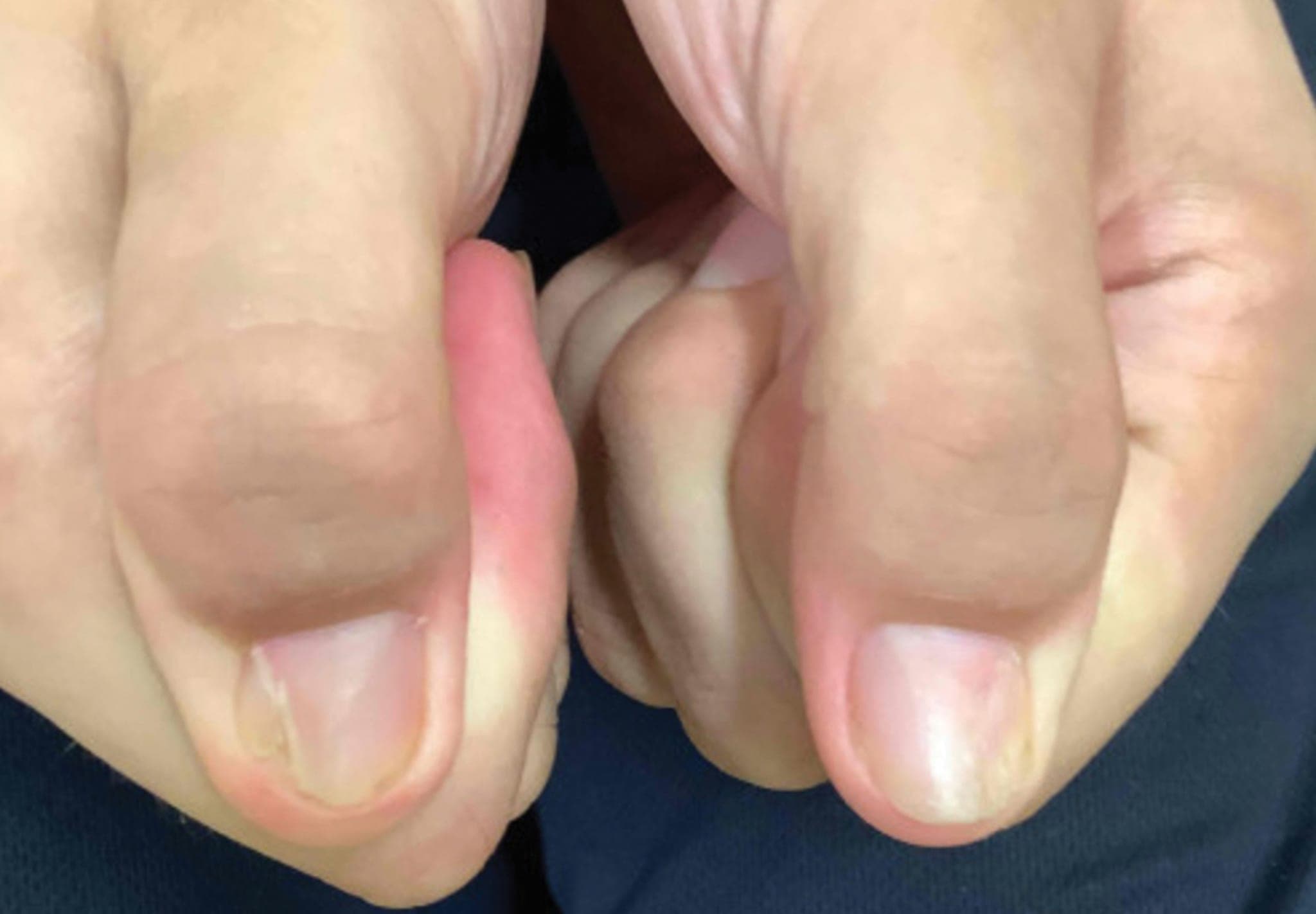 Bild der Woche: Fingernägel